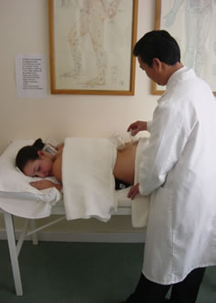 A patient receiving Cupping treatment and being quite comfortable.